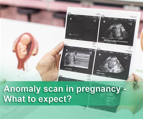 congenital anomaly scan hi precision|Congenital Anomaly Scan Prices: Pregnancy Ultrasound Service.